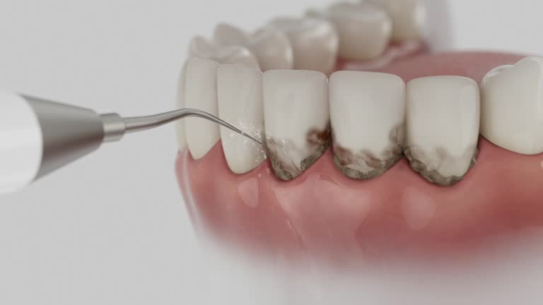 Trusted Root Canal Treatment service in Shields, MI - Dentist Open Now